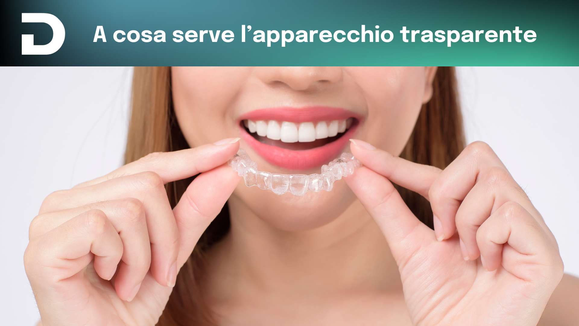 a cosa serve l'apparecchio trasparente | dentalian