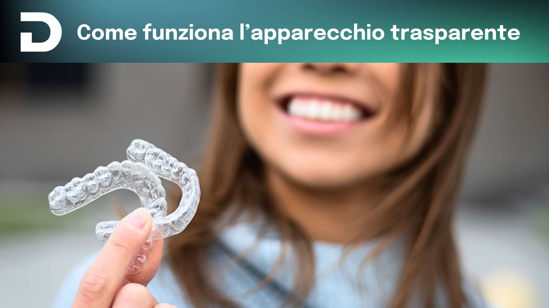 come funziona l'apparecchio trasparente | dentalian