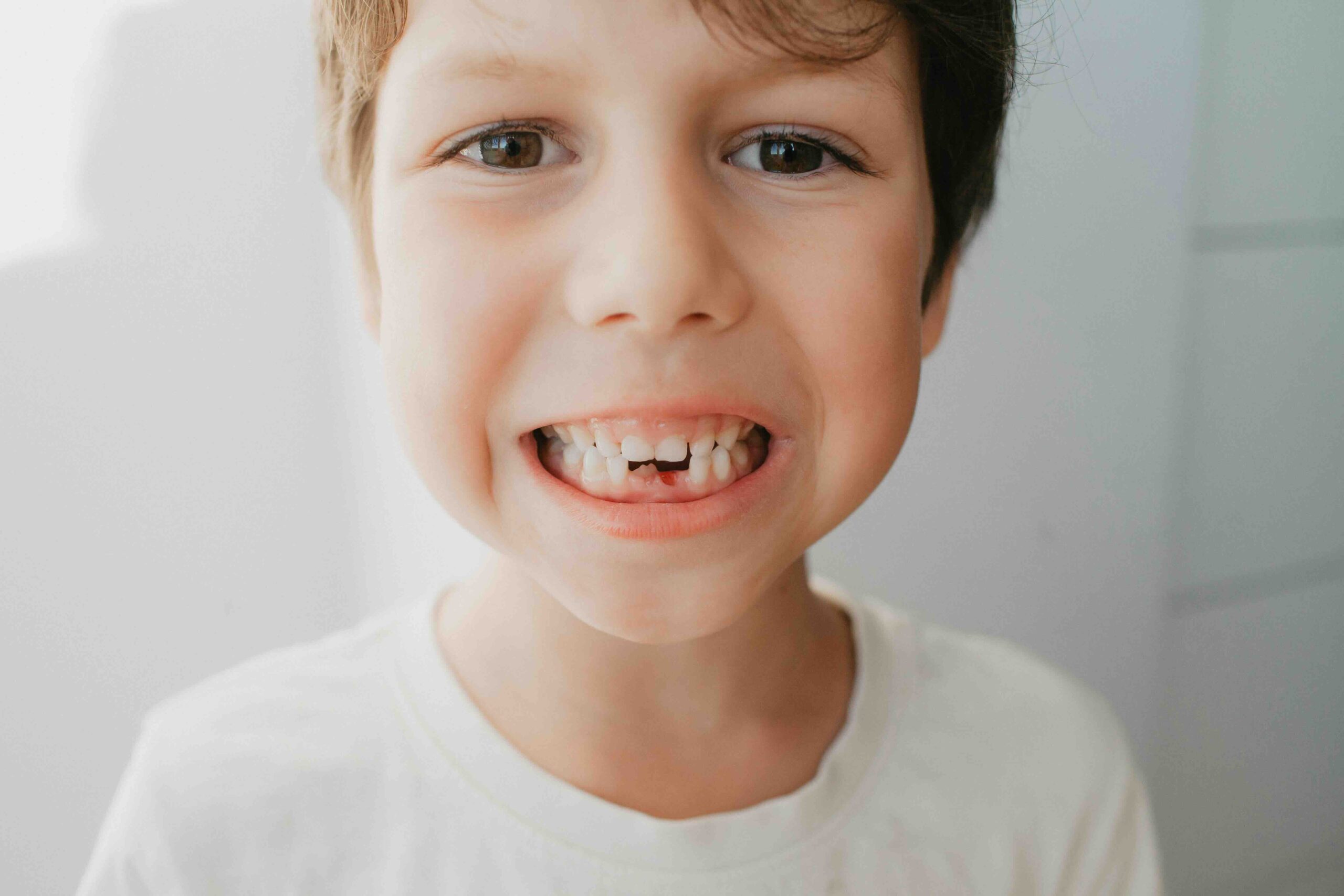 Cosa fare quando cade un dente da latte