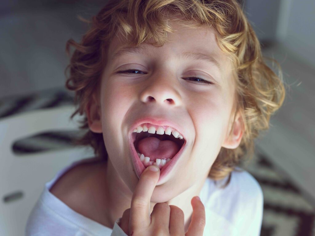 denti da latte