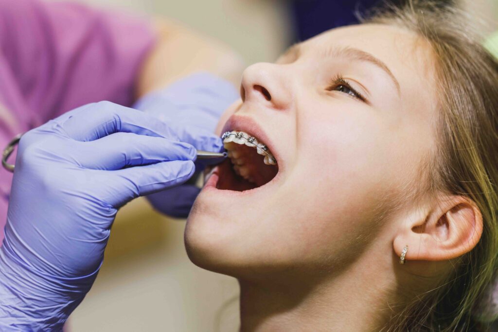 Apparecchio per i denti dei bambini