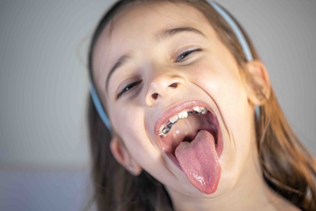 Apparecchio per i denti dei bambini