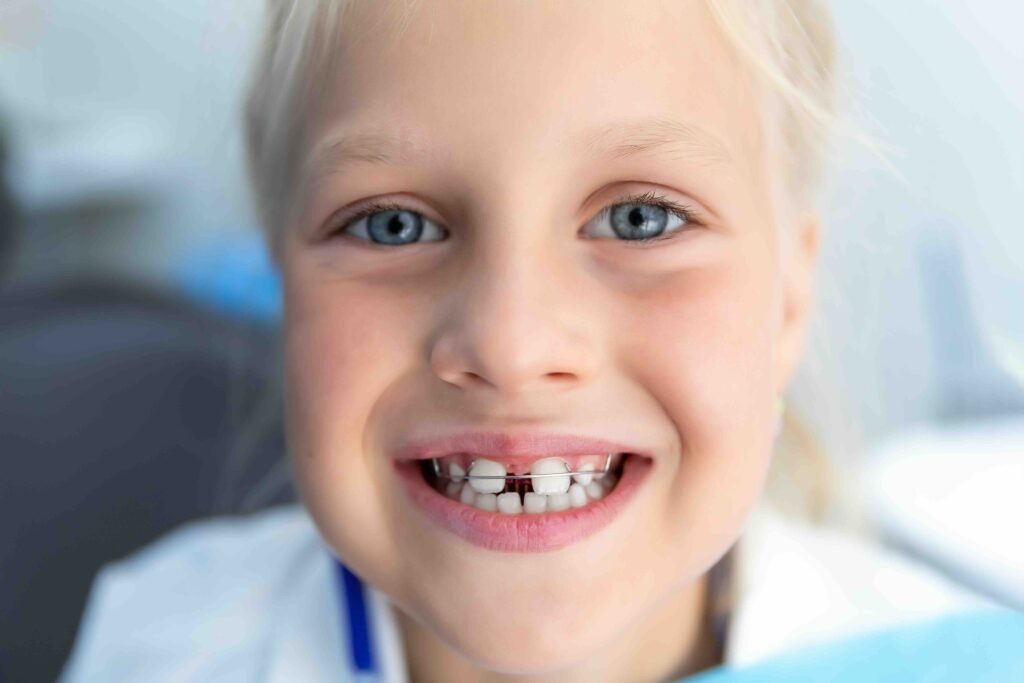 Apparecchio per i denti dei bambini