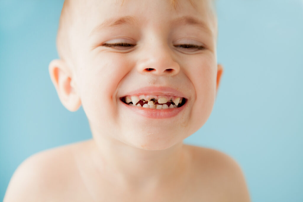 denti da latte